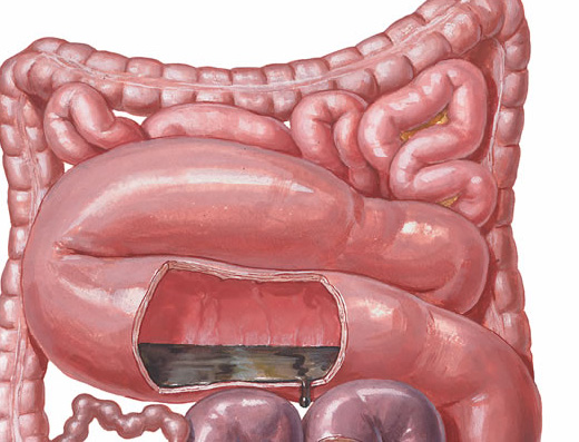 Gastroenterología y Nutrición